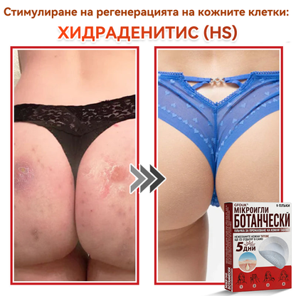 🔥🔥GFOUK® Ботаничен пластир с микроигли за премахване на кожни образувания