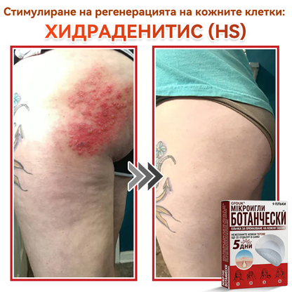 🔥🔥GFOUK® Ботаничен пластир с микроигли за премахване на кожни образувания