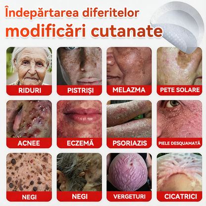 🗽✅ GFOUK® Plasture botanic cu microace pentru îndepărtarea verucilor și a negilor
