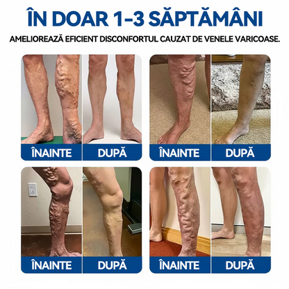 🎁 Au mai rămas doar 5 cutii! Vă oferim o reducere suplimentară de 50%! Mențineți-vă în formă și sănătoși! Profitați acum de această ocazie, pentru că nu veți mai avea o astfel de șansă până anul viitor.