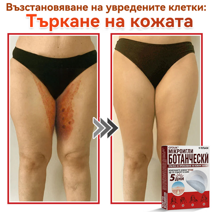 🎁 Остават само 5 опаковки! Сега можете да получите допълнителна ОТСТЪПКА от 50%!🗽✅ GFOUK® Ботаничен пластир с микроигли за премахване на кожни образувания