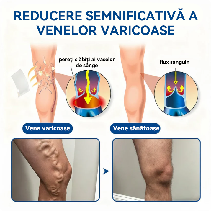 🎁 Au mai rămas doar 5 cutii! Vă oferim o reducere suplimentară de 50%! Mențineți-vă în formă și sănătoși! Profitați acum de această ocazie, pentru că nu veți mai avea o astfel de șansă până anul viitor.