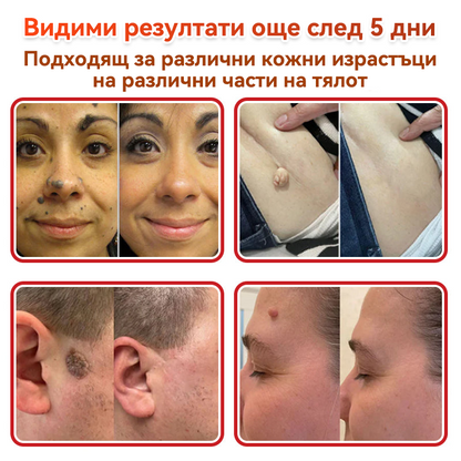 🔥🔥GFOUK® Ботаничен пластир с микроигли за премахване на кожни образувания