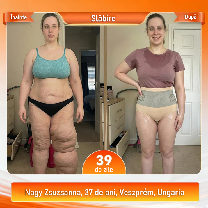 Magazin oficial al mărcii | ✅🛡️ 𝐏𝐀𝐔𝐑𝐀𝐉𝐔® 𝟐𝟎𝟐𝟔 Moringa & Berberină 4-în-1, pantaloni scurți modelatori și pentru arderea grăsimii cu micro-particule.