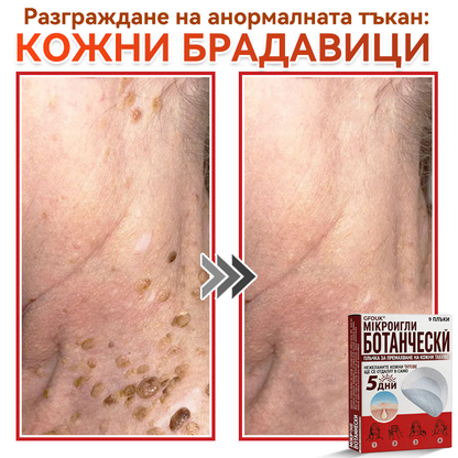 🔥🔥GFOUK® Ботаничен пластир с микроигли за премахване на кожни образувания