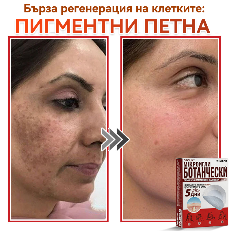 🎁 Остават само 5 опаковки! Сега можете да получите допълнителна ОТСТЪПКА от 50%!🗽✅ GFOUK® Ботаничен пластир с микроигли за премахване на кожни образувания
