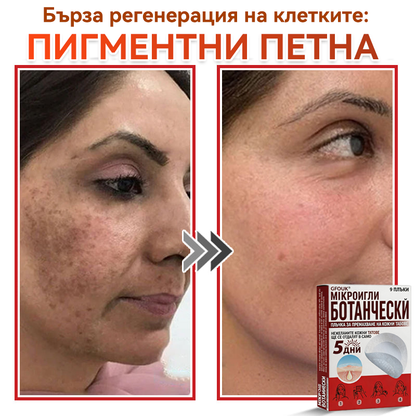 🎁 Остават само 5 опаковки! Сега можете да получите допълнителна ОТСТЪПКА от 50%!🗽✅ GFOUK® Ботаничен пластир с микроигли за премахване на кожни образувания