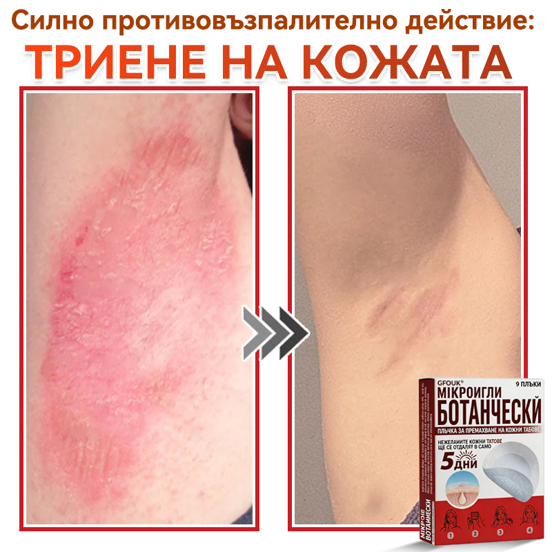 🎁 Остават само 5 опаковки! Сега можете да получите допълнителна ОТСТЪПКА от 50%!🗽✅ GFOUK® Ботаничен пластир с микроигли за премахване на кожни образувания