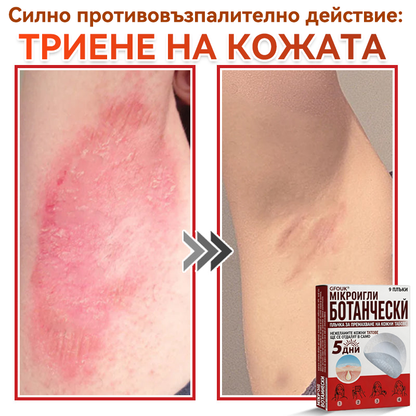 🔥🔥GFOUK® Ботаничен пластир с микроигли за премахване на кожни образувания